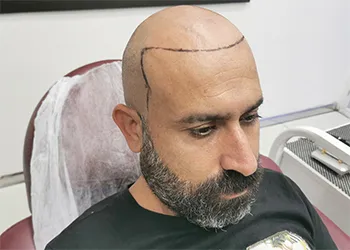 Aydın Saç Simülasyonu