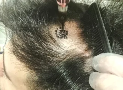 Saç Gölgeleme Nasıl Yapılır?