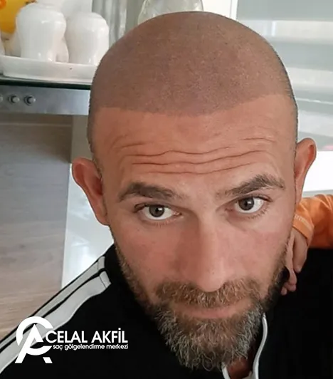 Saç Simülasyonu öncesi ve sonrası