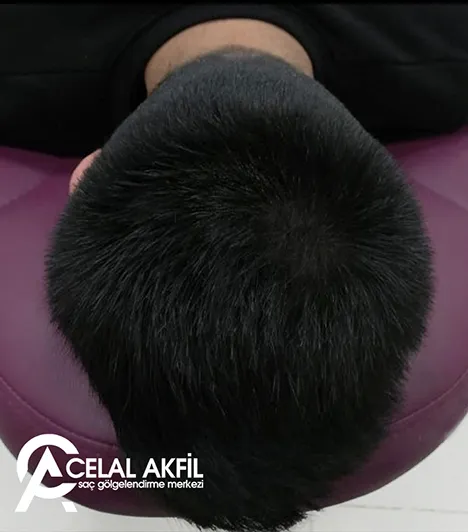 Saç Simülasyonu öncesi ve sonrası