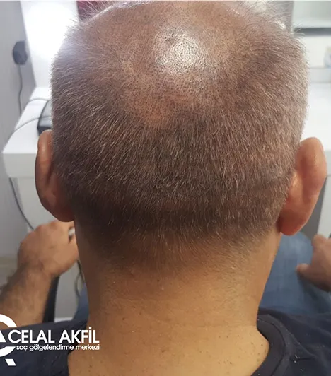 Saç Simülasyonu öncesi ve sonrası