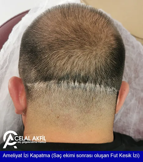 Saç Simülasyonu öncesi ve sonrası