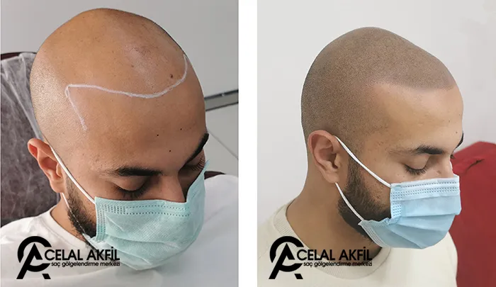 Saç Gölgelendirme Teknikleri